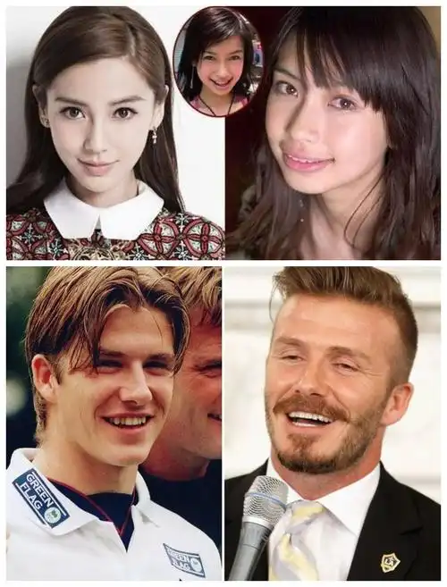 反颌,俗称"地包天"易形成"月牙脸";偏颌导致双侧颜面不对称及颌关系