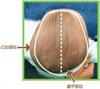 几个月大的新生婴儿能用定型枕吗?