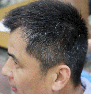 年轻男人长白头发怎么办,头发护理图片,发型图片