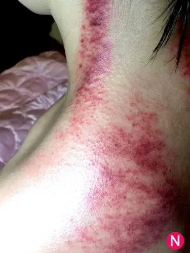 【保养】◢口耳相传的好口碑◣ 头皮肩颈刮痧spa脑袋放空!