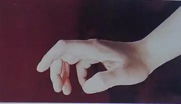 腕背伸20°~25°,拇指掌指关节和指间关节微屈,处于对掌位;其他四指略