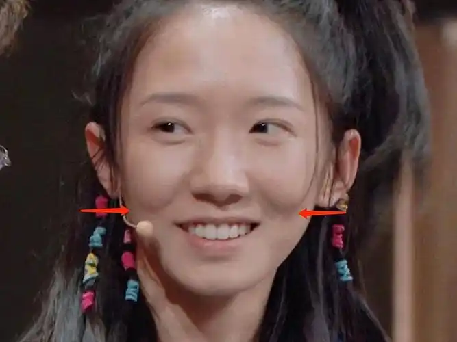 苹果肌下垂会给人一种无力沧桑感