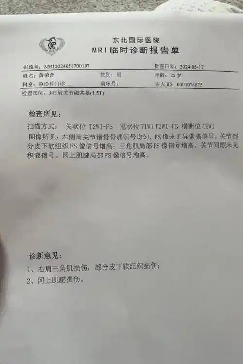3换1,胡明轩下家交易方案出炉!新疆解说被重罚,新疆悍将重伤