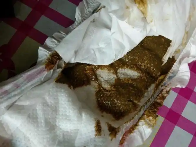 大便这样怎么回事