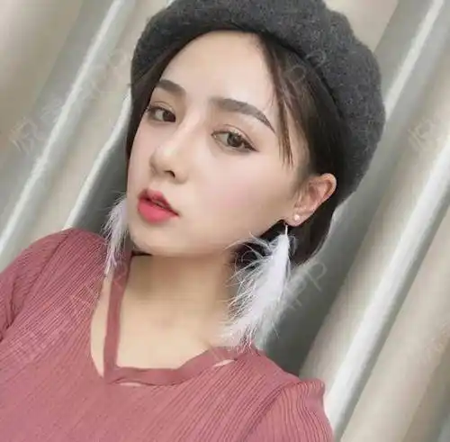 埋线双眼皮术后25天_双眼皮术后25天_眼部整形术后25天_竺元洲邢月琦