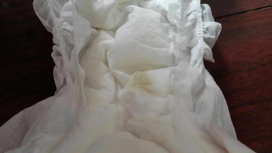 女个月的女宝宝阴道有黄色的分泌物是什么情况?