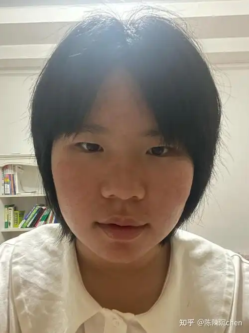 女生长得特别丑怎么办?