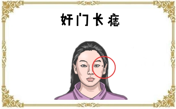 女人5颗"妨夫"痣,婚后拖丈夫后腿,对健康不利!__财经头条