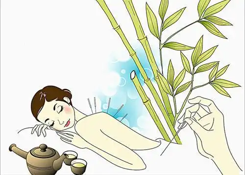 失眠的绿色疗法--针灸治疗