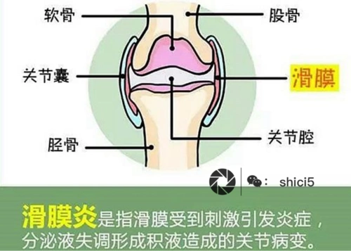 得了滑膜炎别再傻傻的动手术了!——布衣世慈来帮你解决!