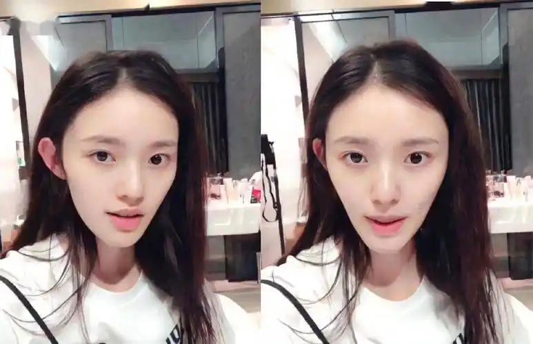 杨紫恋情瓜的后续来了!但脸怎么好像也变了…_牙齿_影响_时候