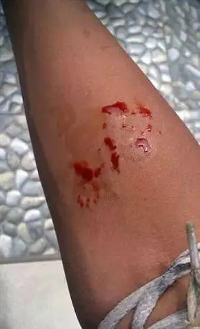 14岁少年被自己眼镜王蛇咬到拍照炫耀,12小时后惨死