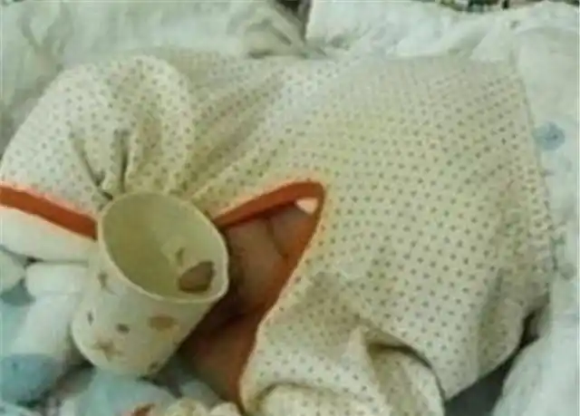 一岁宝宝的蛋蛋毁了只因妈妈对他做了这事这种错很多妈妈犯过