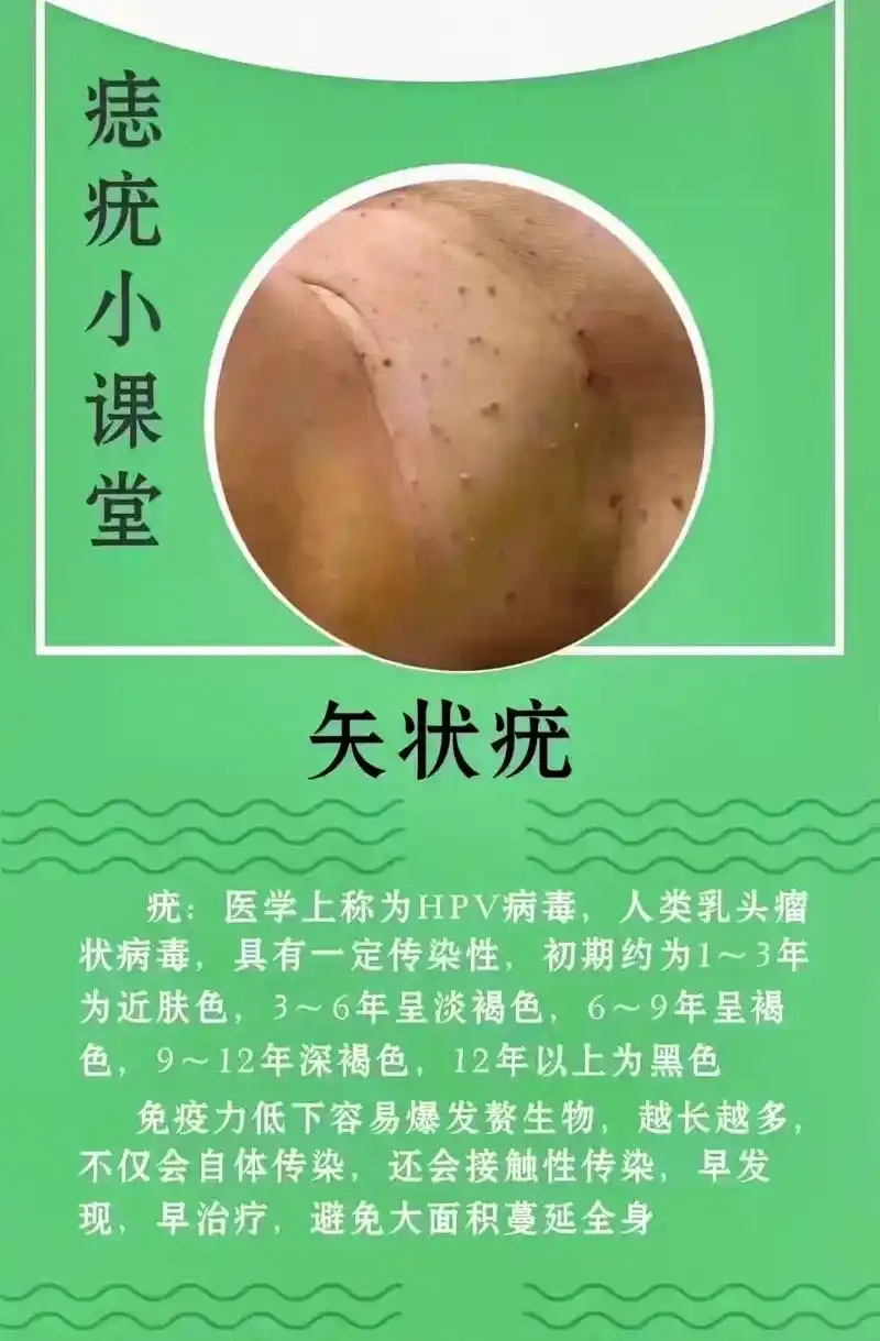 扁平疣,矢状疣,常见脸上, 眼周,脖子,腋下等部位,易自身传 - 抖音