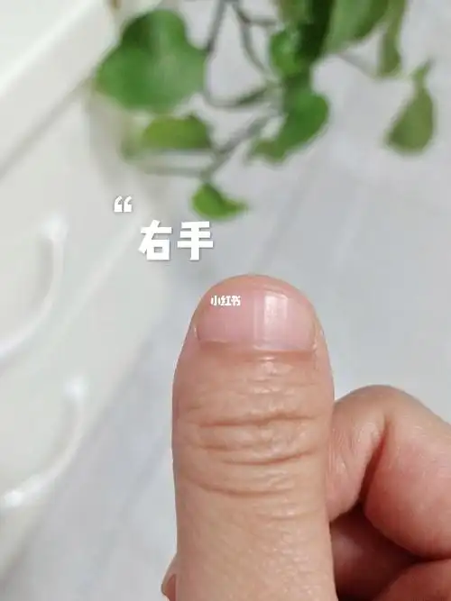 左右大拇指不一样 手指甲又宽又短 有没有同款的姐妹呢?