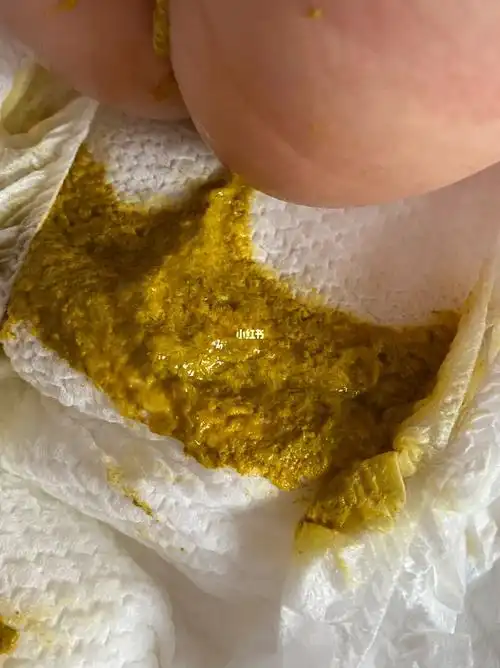 接上篇,目前吃深度水解的第十四天,刚开始喝的第二天就好了,一天大便