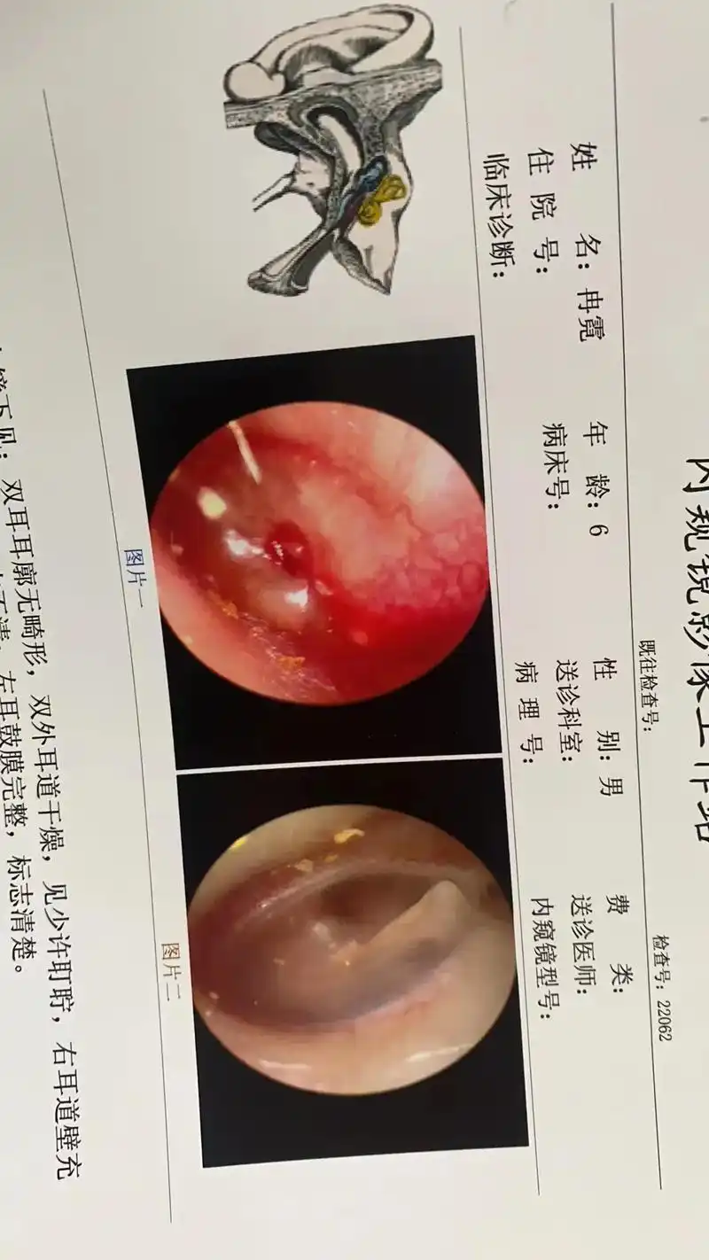 宝贝今天本来可以开开心心过个生日,早上起床就耳朵疼,耳朵发炎 - 抖