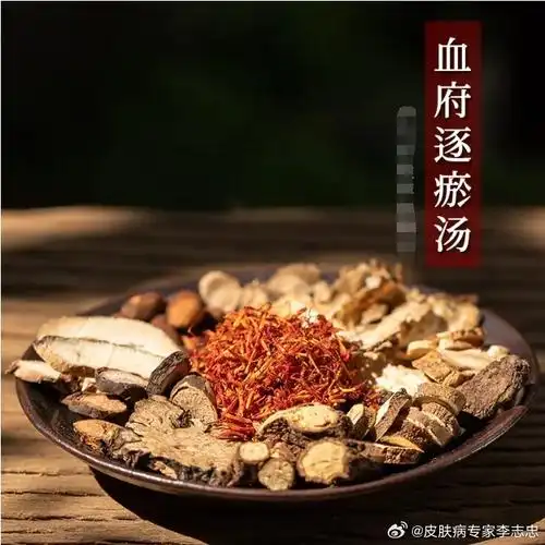 方中桃仁,红花,川芎,赤芍,当归,生地,枳壳,柴胡,牛膝,桔梗,甘草组成