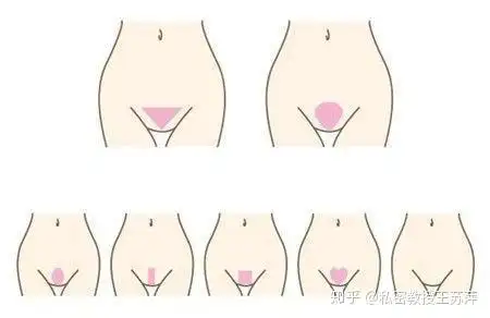 满足了大家的好奇心,关于阴毛形状先讲这么多了,如果还想了解私密阴毛