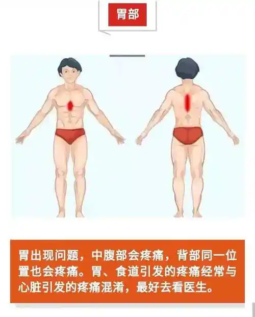 后背疼痛对照表:一图了解原因和治疗方法(后背疼痛原因与治疗方法详解