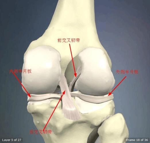前交叉韧带起自股骨外侧髁的内侧面,斜向前下方,止于胫骨髁间隆起的前
