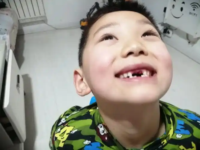 【成长记19】掉牙了