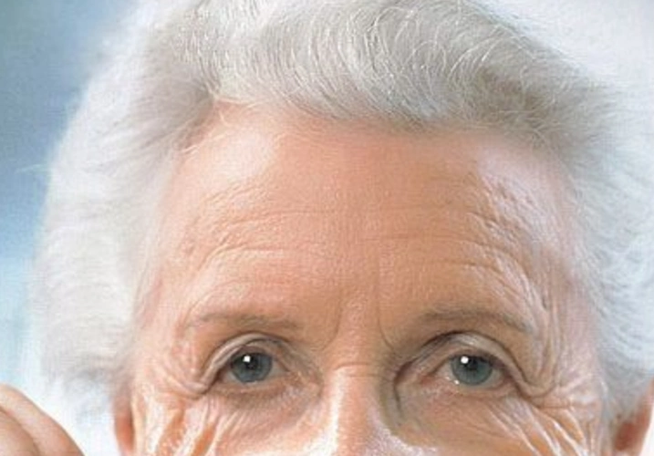 皮肤老化老年女性图片