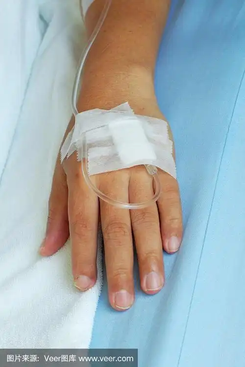 男性病人手上有静脉输液