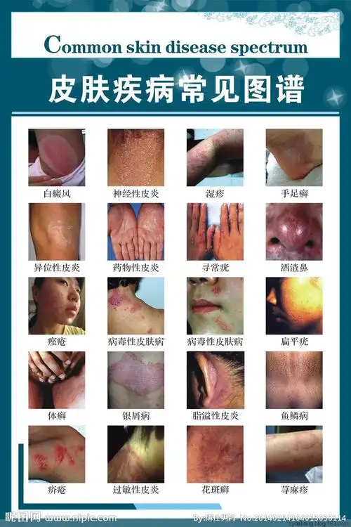 【转载】绝世妙方,治疗各种皮肤疾病"怪"方法