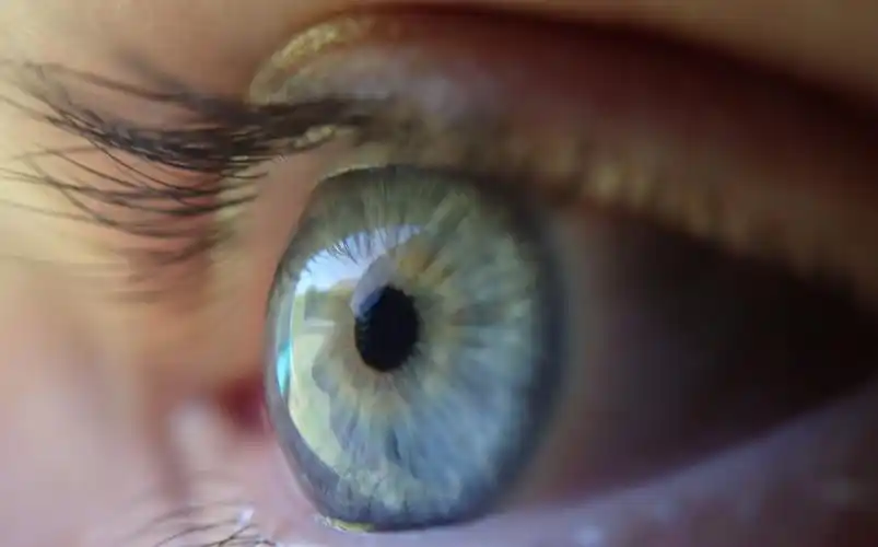 医学博士用1分钟告诉你眼球外凸怎么办