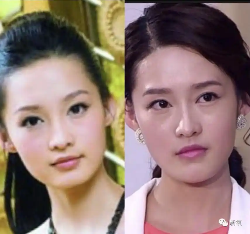 原创李沁到底是不是纯天然超硬核对比分析来了