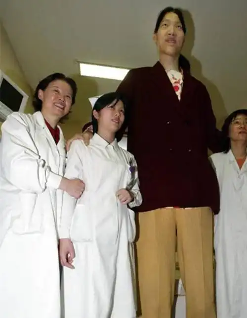 回顾女巨人曾金莲身高2米36却在18岁猝死遗体捐献科学研究