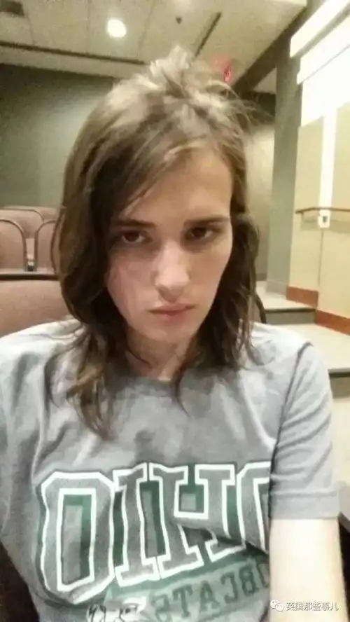 服用雌激素,他记录下自己17个月从帅哥变萌妹的过程,无论怎么都好看啊