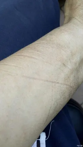 把胳膊勒的一道道红印子,也没找到小卡子