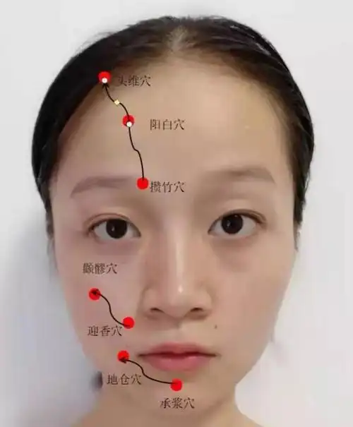 熬夜上网通宵吹空调面瘫了针灸加穴位按摩好了