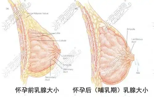 正常乳腺大小很孕期哺乳期乳腺大小差异