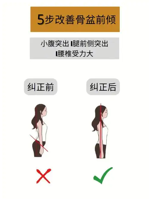 🔥纠正体态,6招有效改善骨盆前倾!!