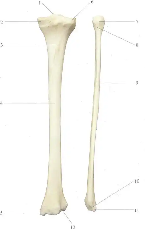 图4-105 胫,腓骨(后面观)-骨科临床解剖学-医学