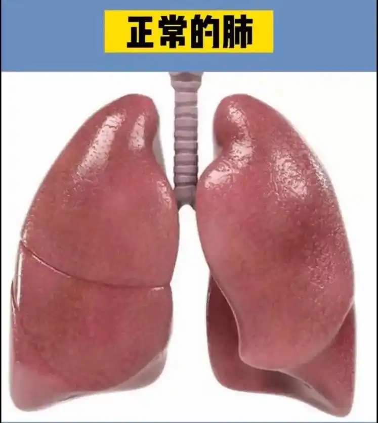 健康科普&我们的肺.#健康 #健康科普 #健康养生 #知识分 - 抖音