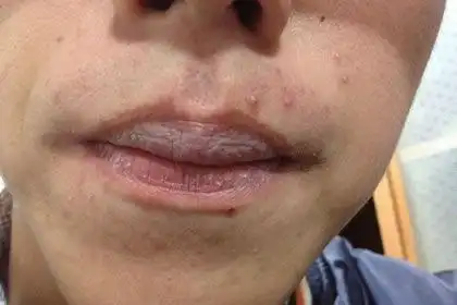 嘴角下垂的男人在运势上有什么需要注意的