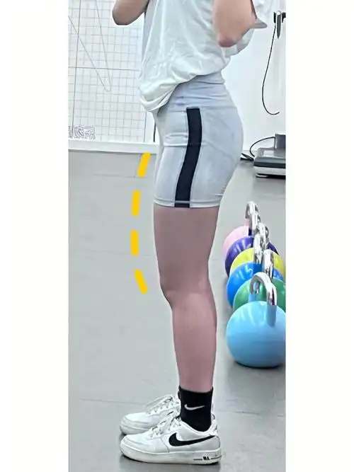 大腿前面突出的肉咋减啊