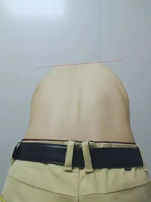 封面如何检查脊柱侧弯古医君给你支个招