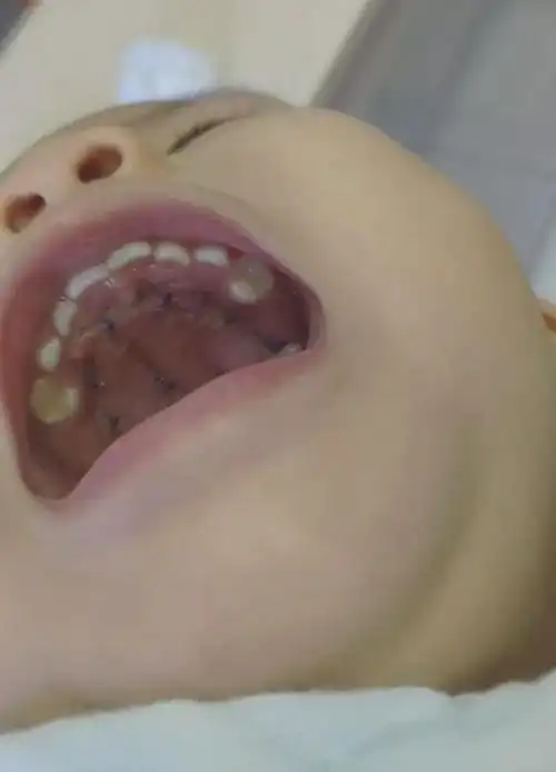 我的宝宝在新加坡刚出生,就迎接挑战~|癌症|手术|新生儿|细胞瘤_网易