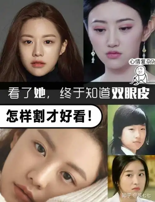 自然款双眼皮整形模版!欢迎自取 - 知乎
