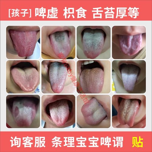 健脾养胃婴幼儿调理脾胃宝宝舌苔厚内热胀气厌食寒湿重消积食草本
