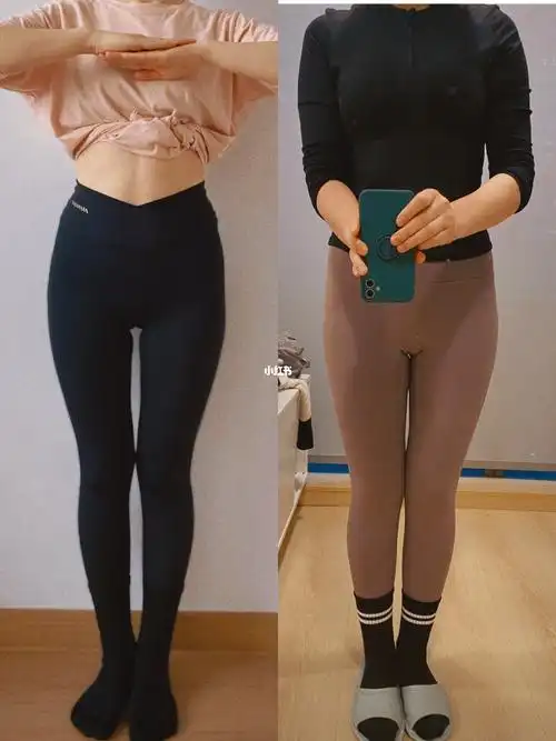 xo型腿一个月后的变化