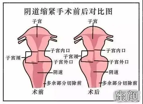 私密整形追求美丽是女性一生的事业