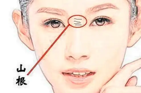 鼻头上方上有横纹面相(鼻头上方有道横怎么回事)