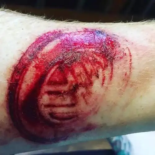 大众车主驾驶高尔夫遭遇车祸?手臂被刻下vw"血之印记"