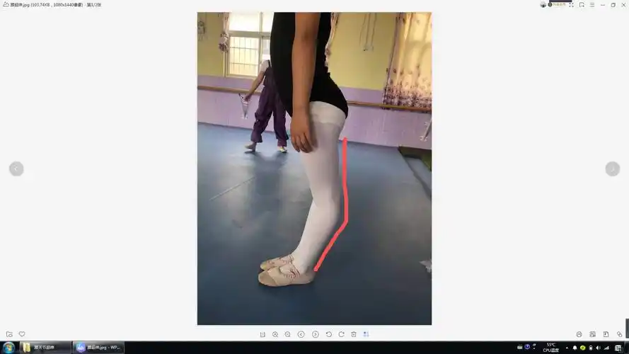 膝关节超伸孩子在我们练功时候要注意些什么?